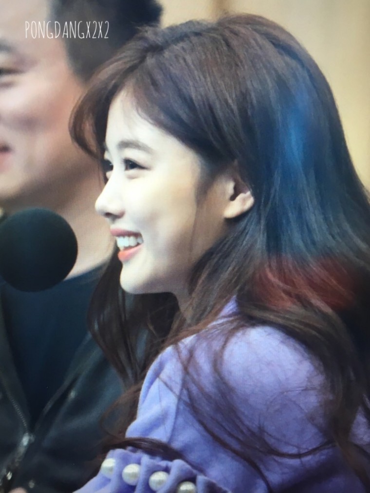 전날 사랑니 빼서 얼굴 부은 김유정 .JPG | 인스티즈