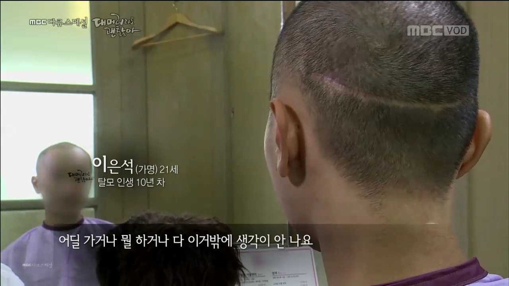 탈모 환자가 받는 스트레스... | 인스티즈