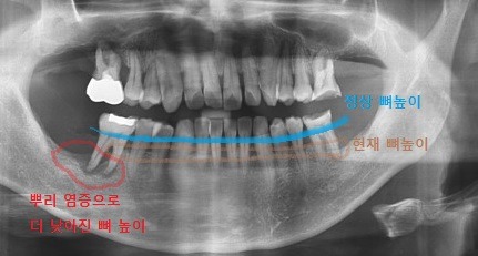 알아두면 좋은 치과 상식 (3) | 인스티즈