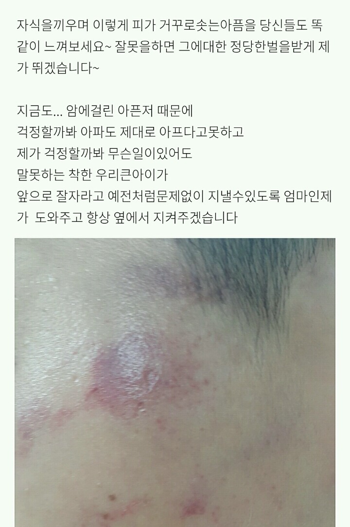 저희 아들이 집단 폭행을 당했습니다 jpg | 인스티즈