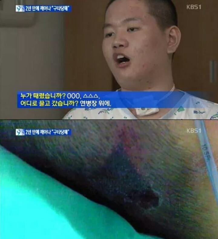 군대에서 식물인간이 된 청년이 2년만에 깨어나서 한 진술 | 인스티즈