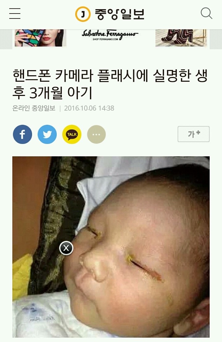 핸드폰 카메라 플래시에 실명한 생후 3개월 아기 | 인스티즈
