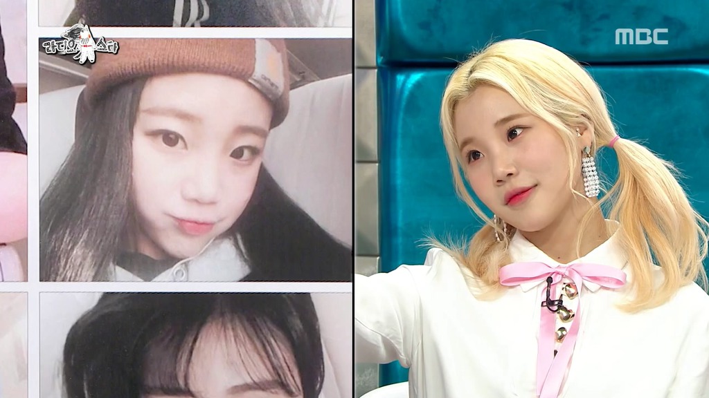 [라디오스타] 코수술 사실을 소속사에 숨겼다가 딱 걸린 주이.jpgif | 인스티즈