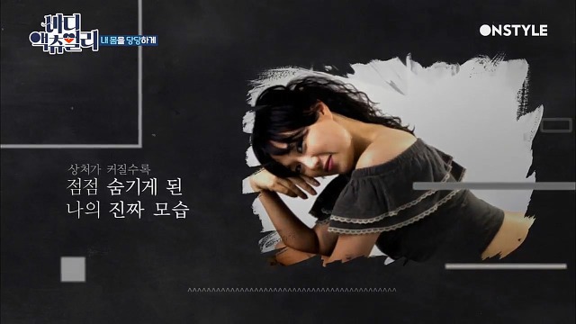 전신탈모증 윤사비나씨가 생각하는 아름다움.jpg | 인스티즈