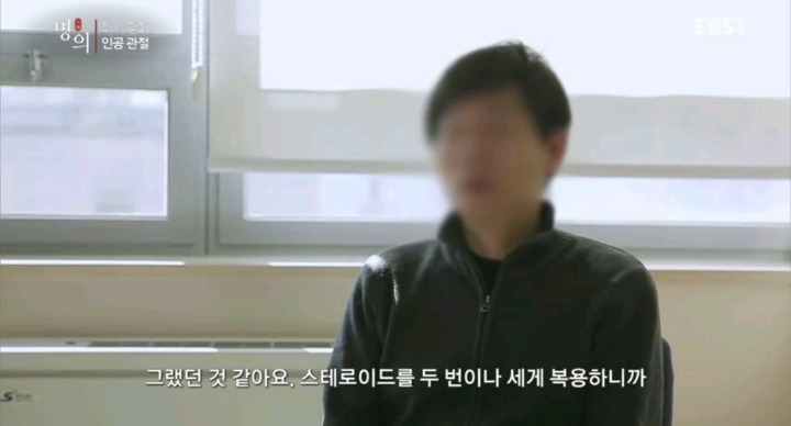 무서운 스테로이드 부작용.jpg | 인스티즈